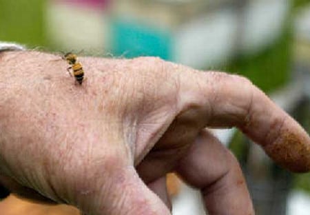 как поступить при укусе осы